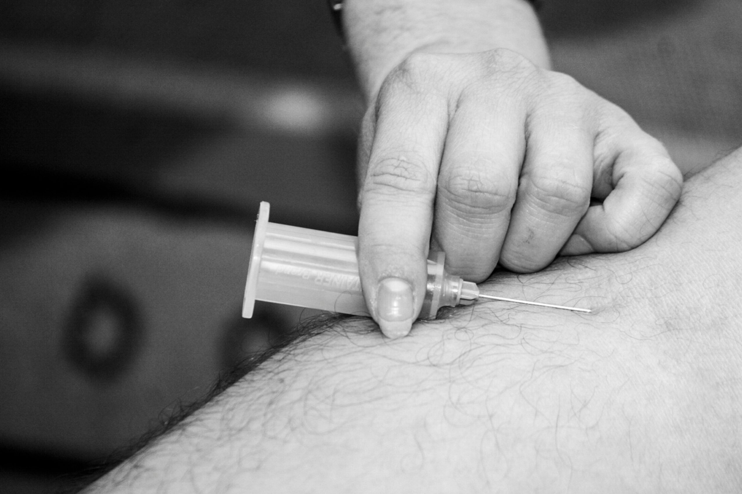 What is the process of receiving a p shot, step by step?